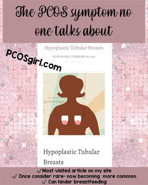 torpedoboobs|Hypoplastic Breast Anomalies in the Female Adolescent Breast.